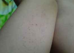 °×ñ°·çÖ¢×´ °×ñ°·çÖ¢×´