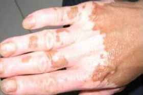 �������Ϊʲô��������