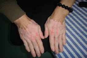 ��ô���ԸϿ��κð��粡֢��